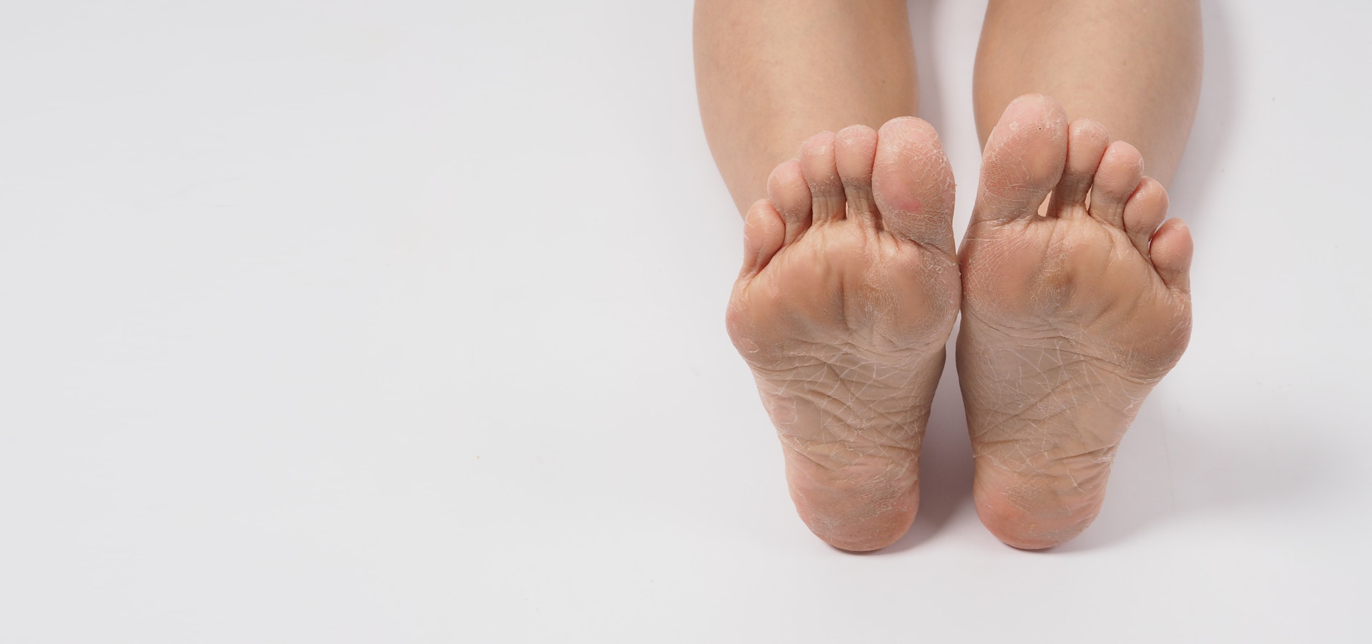 Foot peeling or remove dead skin on white background.